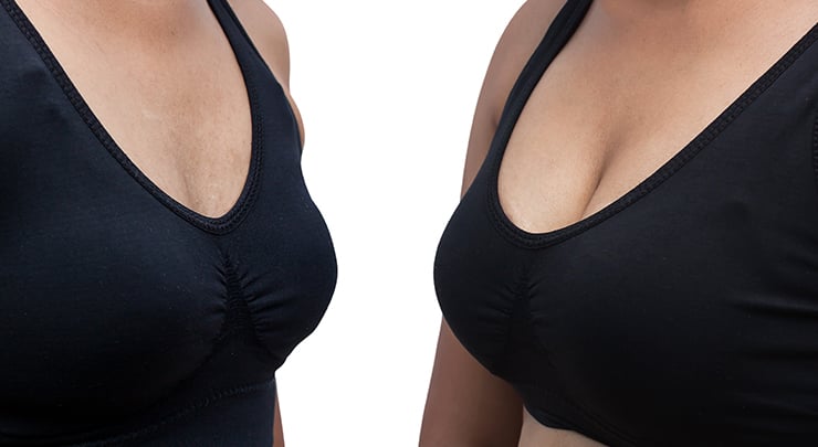 34B BREAST ENLARGEMENT Perky bigger boobs bust lift larger increase tit size  bra